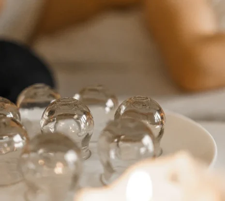 Glass cupping therapy tools at Shelley Jones Acupuncture, Coxley