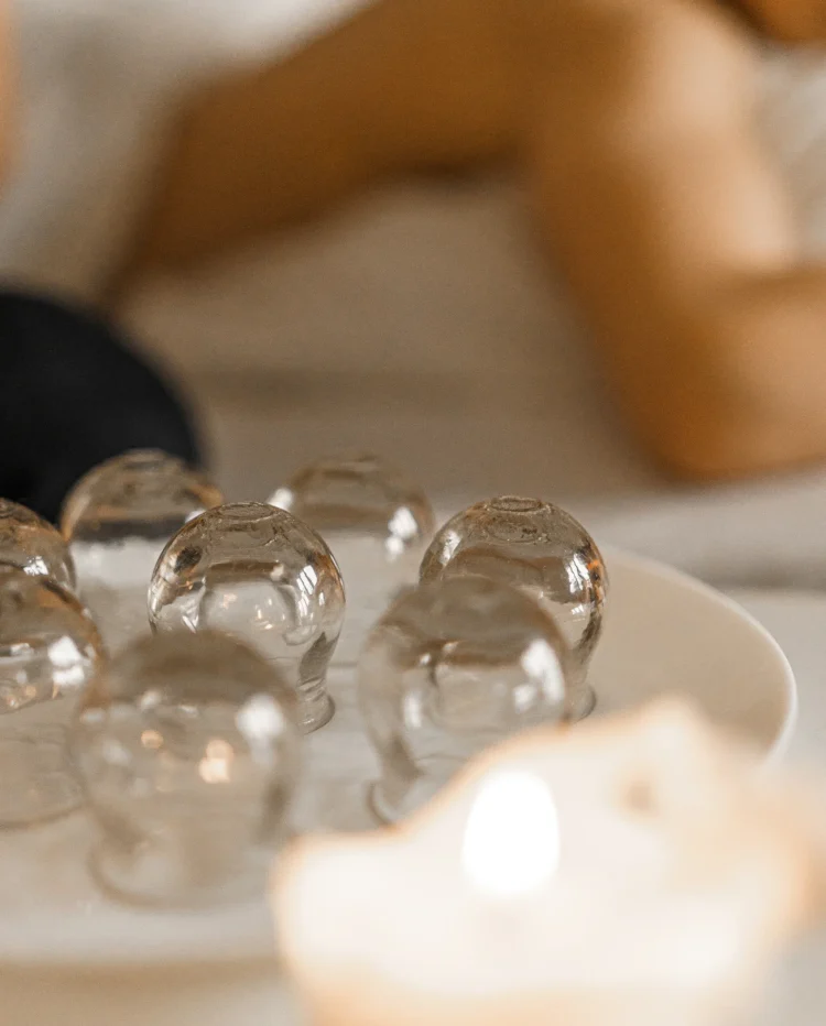 Glass cupping therapy tools at Shelley Jones Acupuncture, Coxley